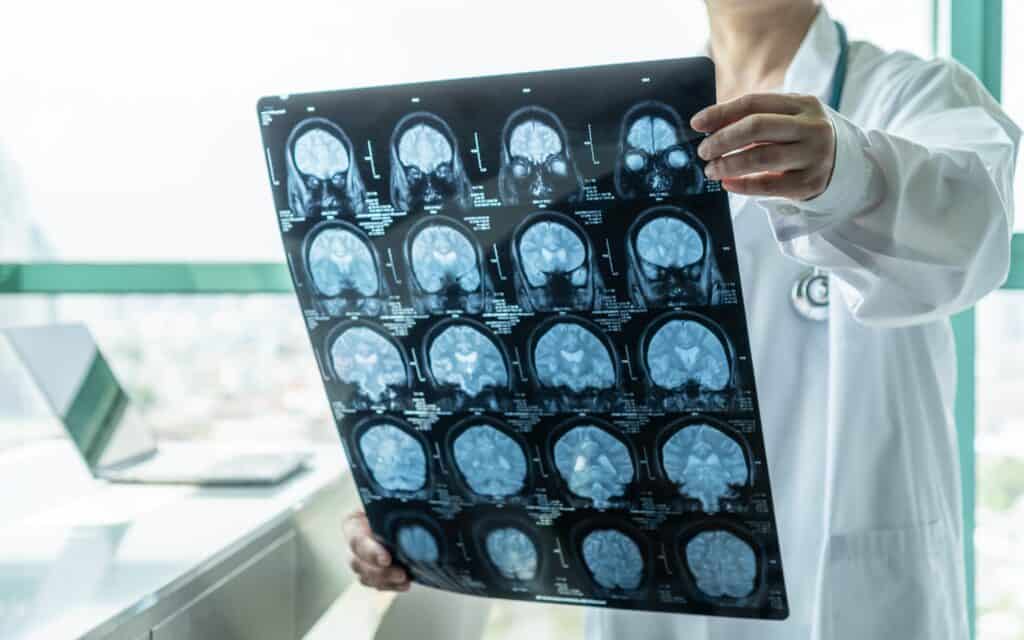 Los Angeles Catastrophic Injury Lawyer