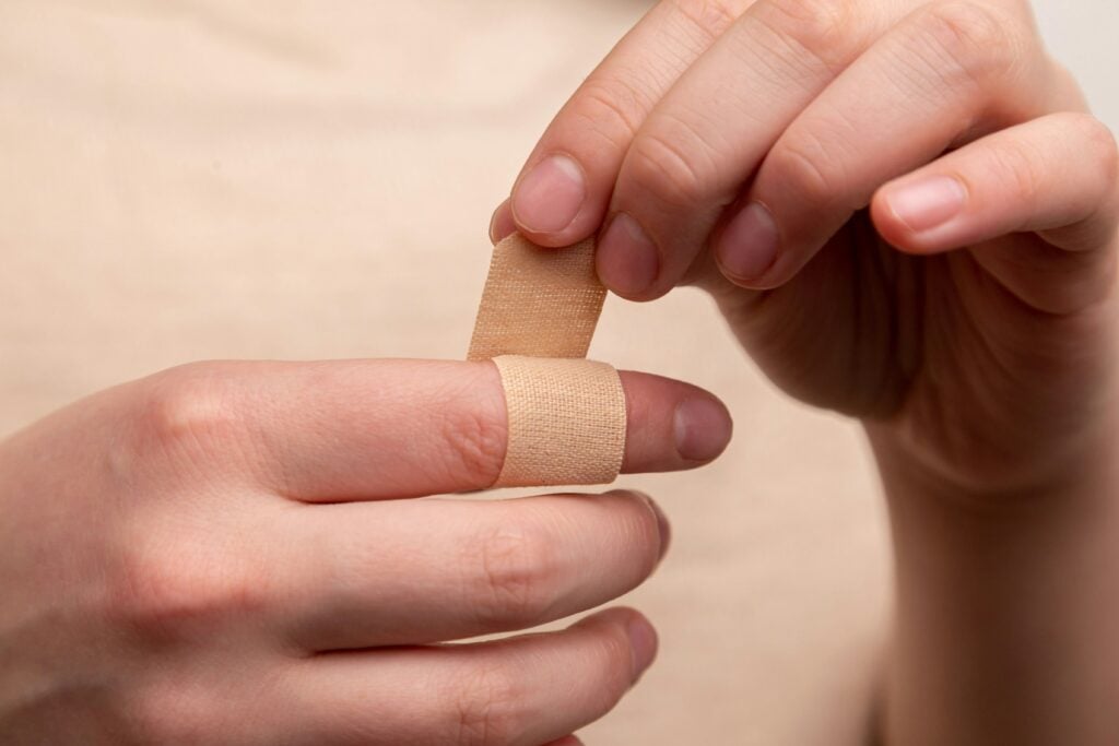 Una mujer muestra su mano lesionada tras usar productos defectuosos.