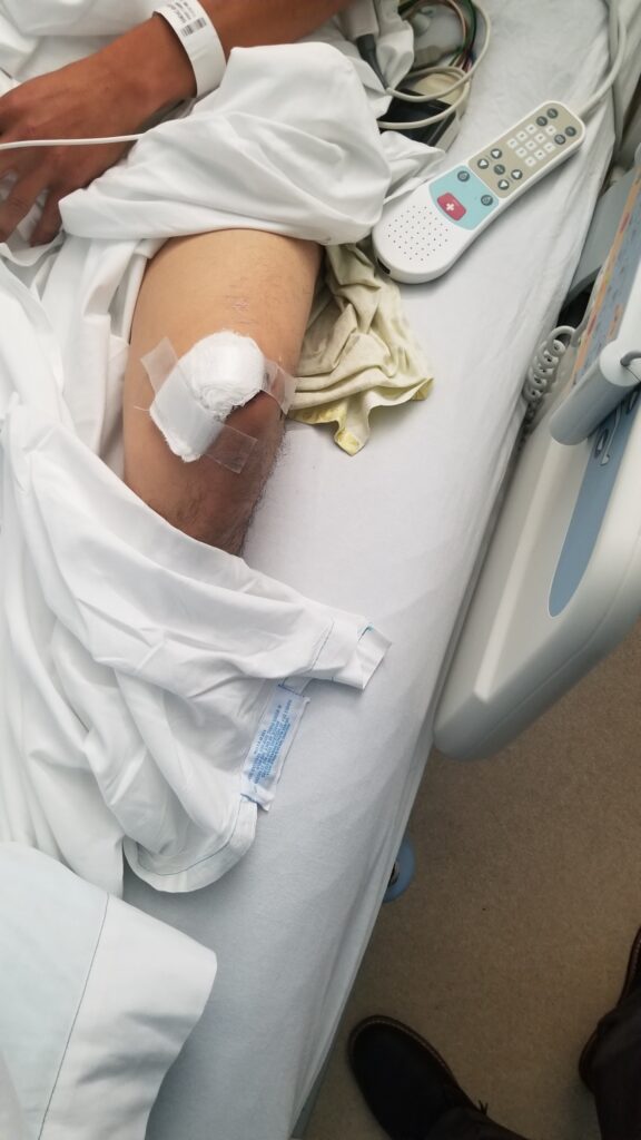 The motorcycle accident caused severe injury to the victim's knee.