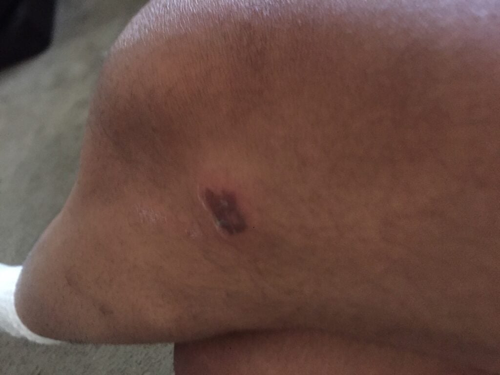 La víctima presentaba dolores y abrasiones en la rodilla izquierda.