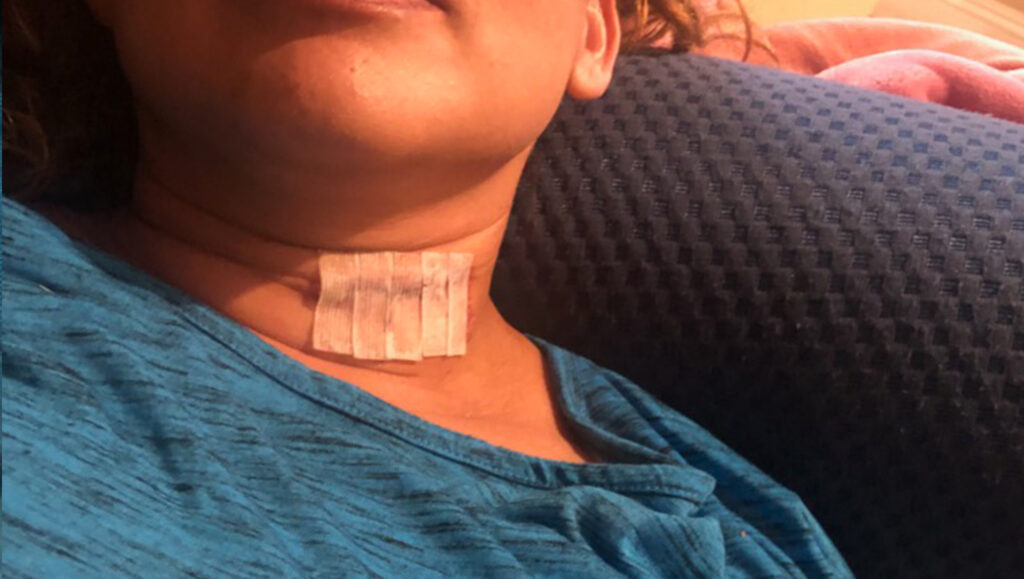 Una menor que estaba en el coche golpeado también sufrió heridas de gravedad.