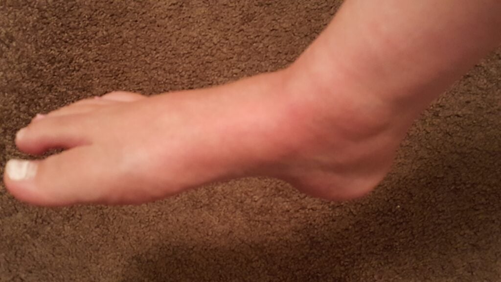 The victim's swollen ankle.