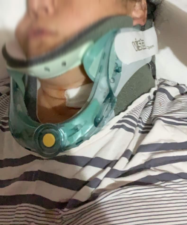 The rear-end accident left the victim with severe neck injuries.