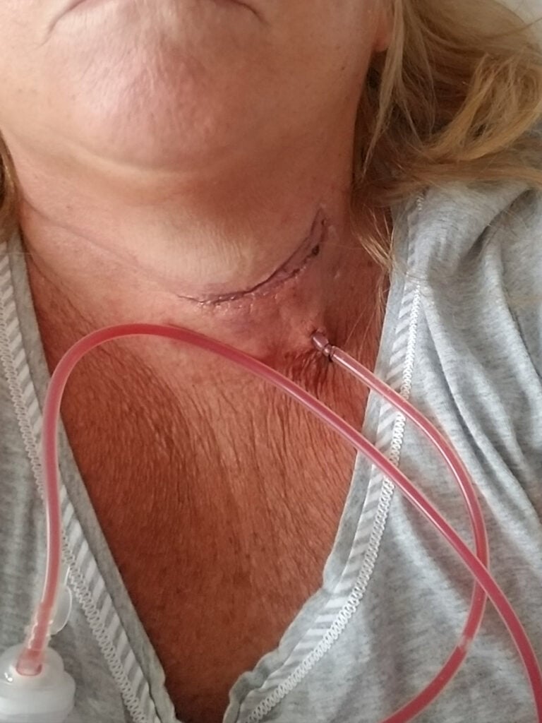 La víctima padeció severos problemas de salud por la caída.