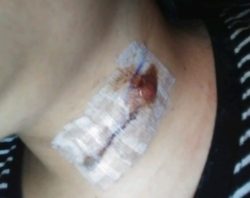 One of the victims was seriously injured with a deep cut to the neck.