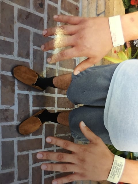The hands of the victim after the attack by the security guards.