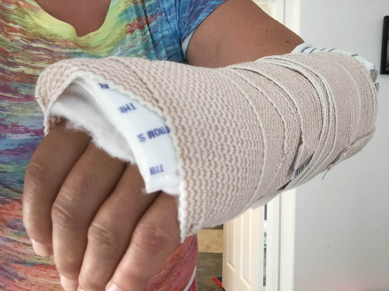 The victim suffered a fractured left arm after tripping on a raised concrete lip.