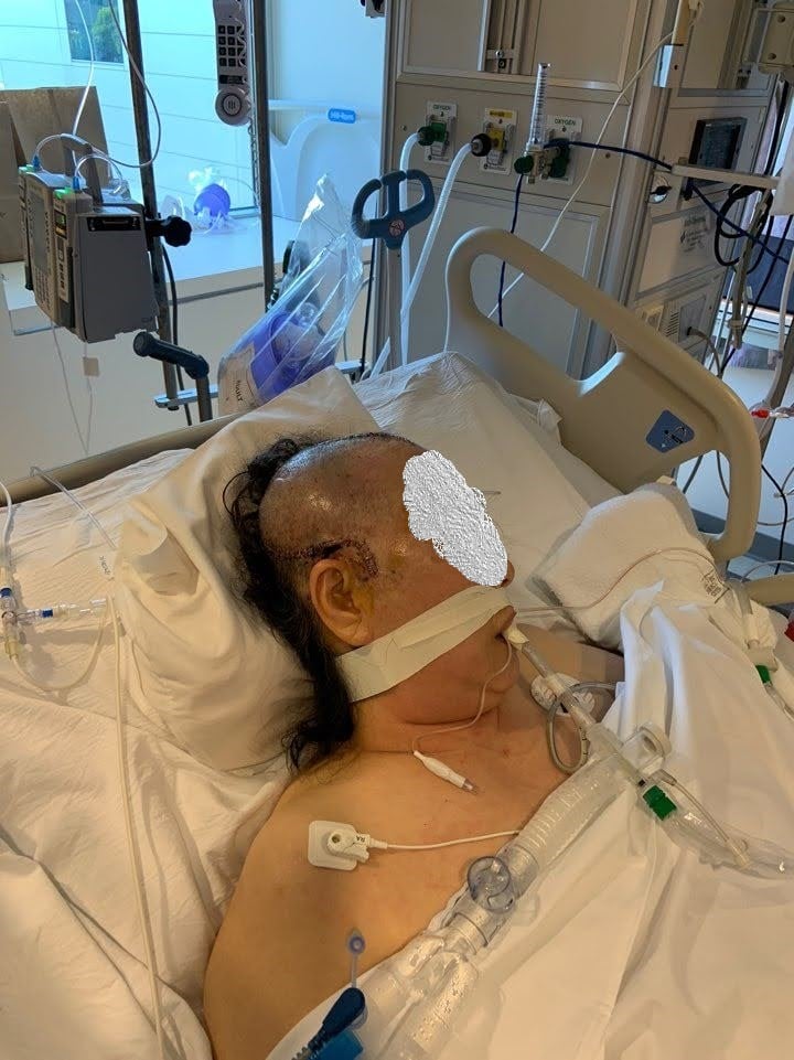 The victim was left a quadriplegic after suffering severe brain damage.