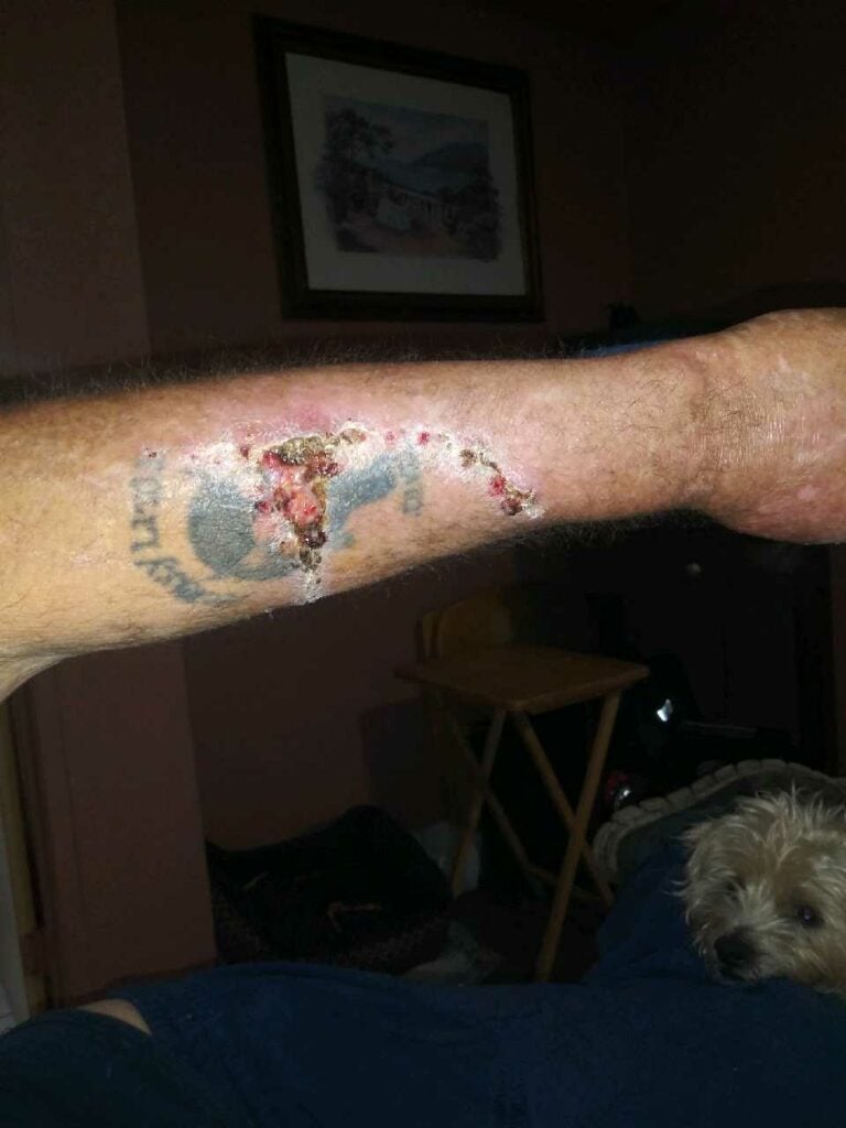 Victim of brutal accident shows injuries.