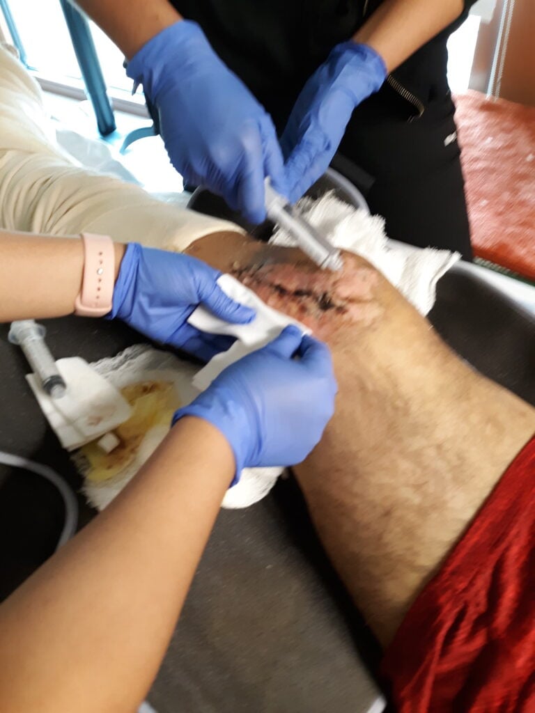 Doctors treat the pedestrian's leg after a semi truck accident.