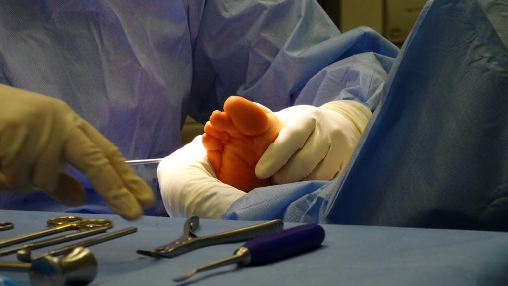 When Everyday Products Fail: Calculating the True Cost of a Defective Product Injury